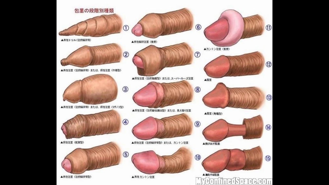 Types Of Penis Pictures 119